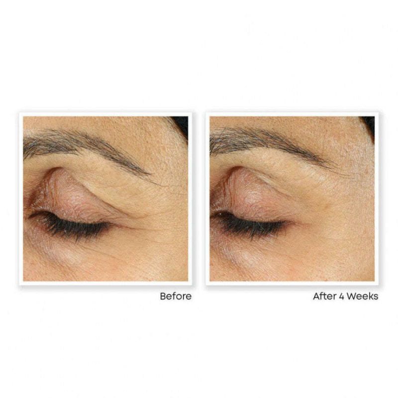 Roc Retinol Correction Line Smoothing Eye Cream - Image 6