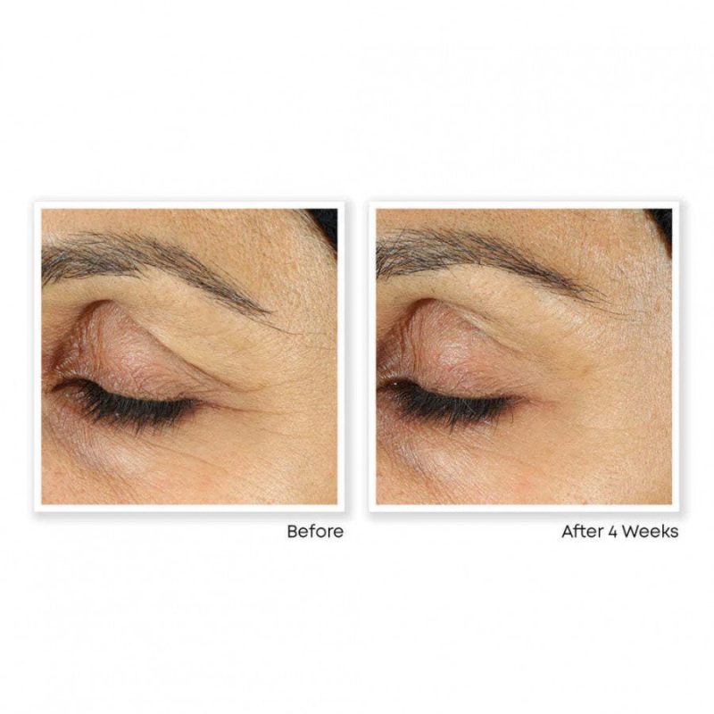 Roc Retinol Correction Line Smoothing Eye Cream - Image 4